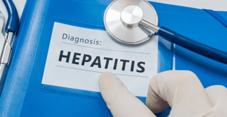 Hepatitis